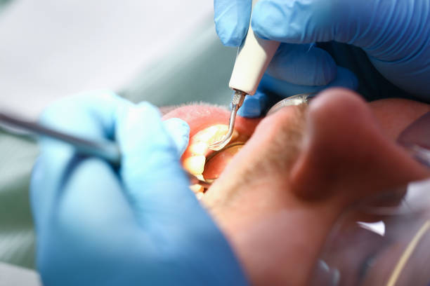 Best Weekend Emergency Dentist in Commercial Point, OH