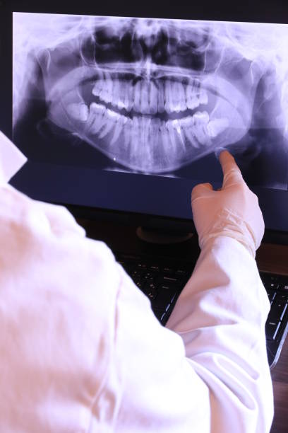 Best Emergency Dentist for Lost Fillings or Crowns in Commercial Point, OH