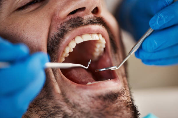 Best Mobile Emergency Dentist in Commercial Point, OH